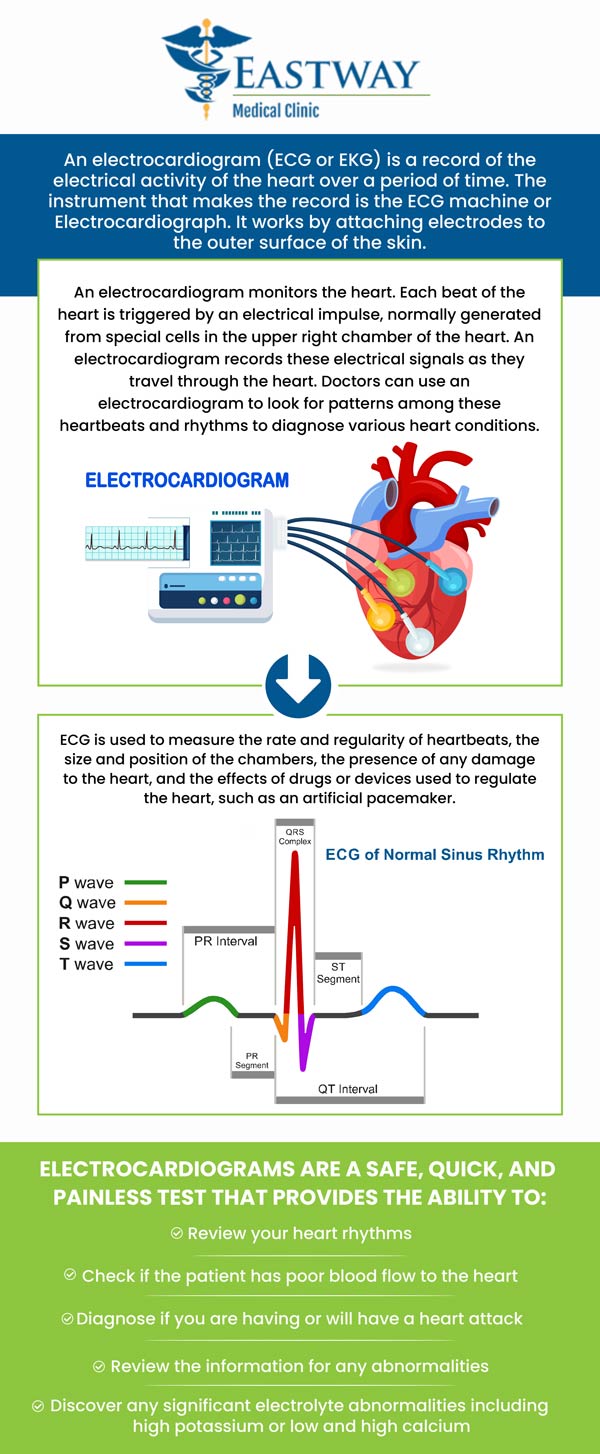 EKGs are frequent and painless tests performed to quickly recognize cardiac issues and keep records on the condition of the heart. Electrocardiograms (EKGs) are performed by Dr. Sylvia, Okoye, MD., and Dr. Joseph Okoye, MD., at Eastway Medical Clinic and Urgent Care to determine the causes of electrical cardiac issues for providing an accurate diagnosis and personalized care to the patients. For more information, please contact us or book an appointment online. We are conveniently located at 1220 Eastway Drive Charlotte, NC 28205.
