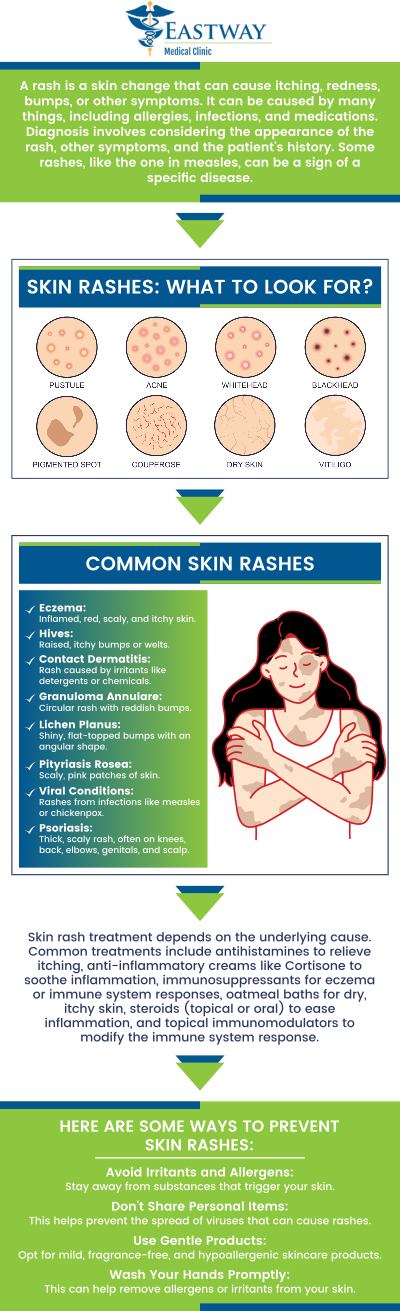 Rashes can be bothersome and painful. Many rashes are irritating, itchy, red, and painful. Some rashes can also cause blisters or wounded skin patches. If you have a rash and need it treated, then visit Dr. Joseph Okoye, MD, and Dr. Sylvia Okoye, MD, who offer comprehensive rash treatment in Charlotte, NC. We are conveniently located at 1220 Eastway Drive Charlotte, NC 28205. For more information, please contact us or request an appointment online.